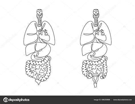Anatomická kresba ľudského konečníka s vyznačenými vnútornými a vonkajšími hemoroidmi