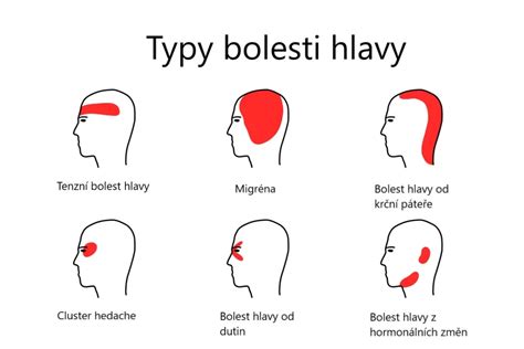 Bylinky na bolesti hlavy