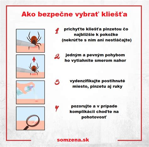 Schéma správneho odstránenia kliešťa pinzetou
