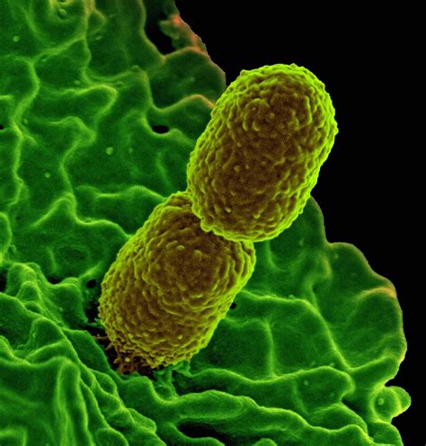 Baktéria Klebsiella pneumoniae