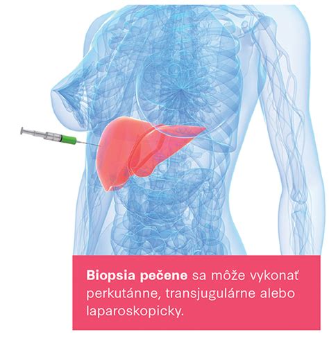 Metódy diagnostiky cirhózy pečene