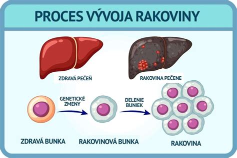 Schéma ľudskej pečene a jej funkcií