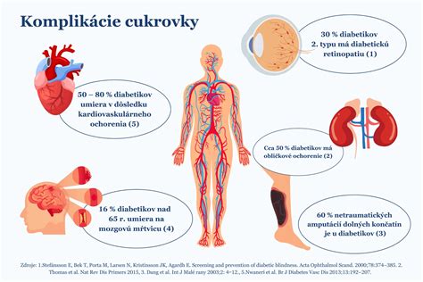 Infografika o cukrovke