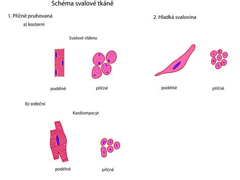 Schéma štruktúry svalu a typov svalových poranení