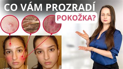 Pokožka pred a po použití arganového oleja