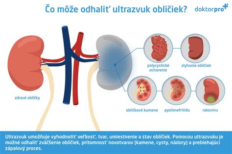 Urológ vykonávajúci ultrazvukové vyšetrenie močového mechúra