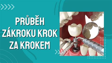 Fázy rekonvalescencie po urologickom zákroku (ilustrácia)