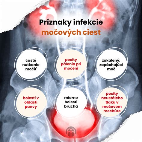 Vizualizácia zdravých močových ciest vs. močových ciest s uretritídou