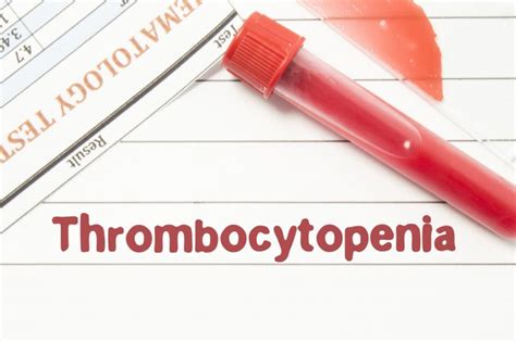 Schéma: Príčiny a príznaky trombocytopénie