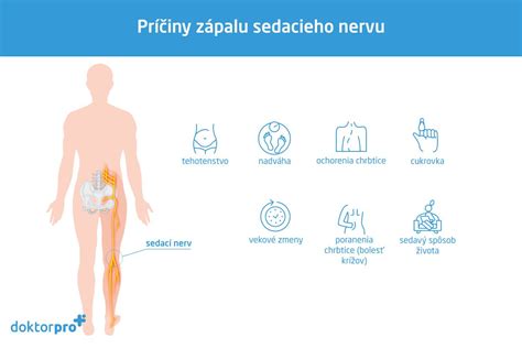 Anatomické zobrazenie sedacieho nervu