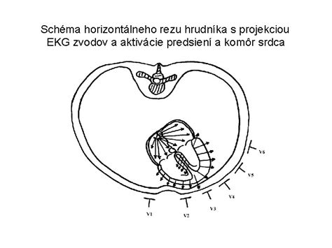 Schéma zmladzovacieho rezu broskyne