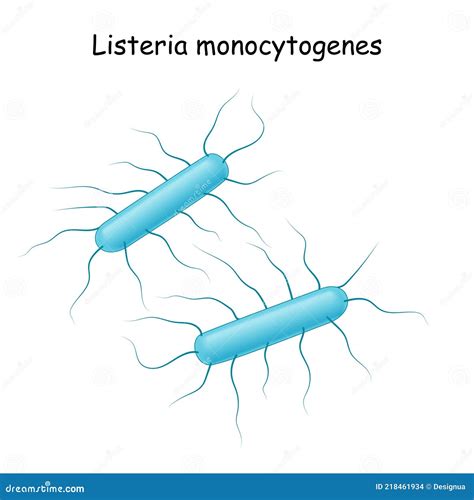 Grafika: Riziká baktérie Listeria monocytogenes