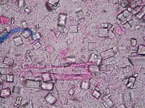 Rôzne typy kryštálov v moči psa pod mikroskopom