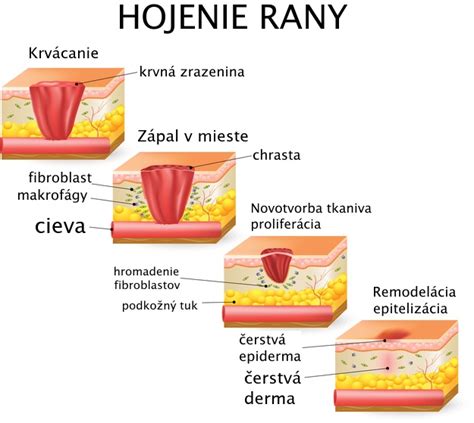 Schéma fáz hojenia rany