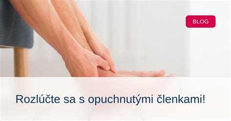 Opuchnuté členky ako príznak ochorenia pečene
