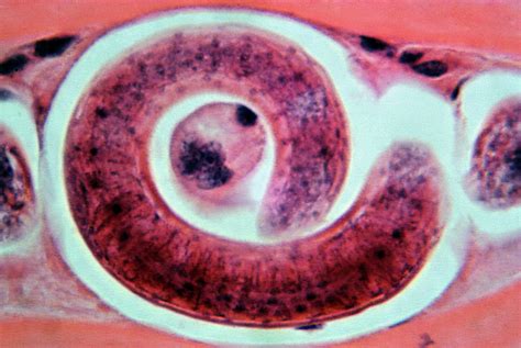 Mikroskopický pohľad na larvy Trichinella spiralis v svalovom tkanive