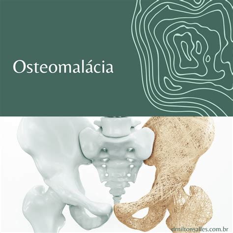 Osteomalácia - poškodenie kostí