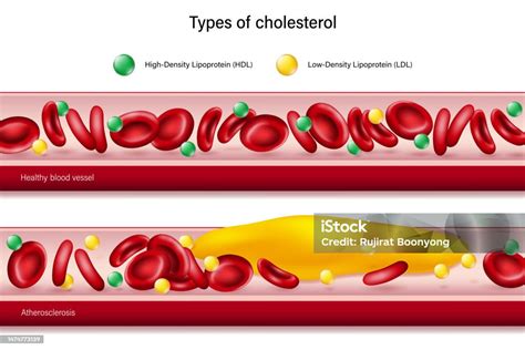 Grafika: ako betaglukány znižujú cholesterol