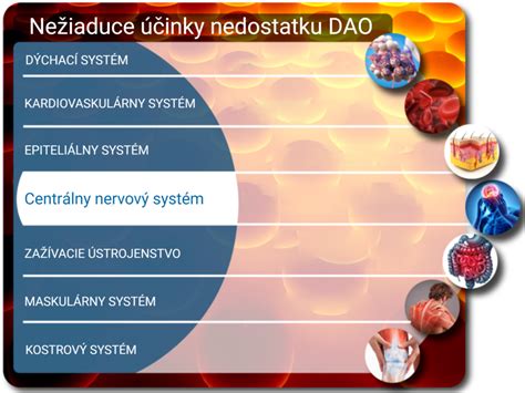 Schéma: Metabolizmus histamínu a úloha enzýmu DAO