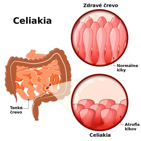 Schematické znázornenie správneho a nesprávneho porovnávania
