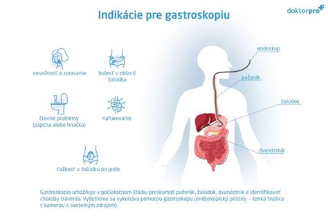 Infografika: Indikácie pre gastroskopiu