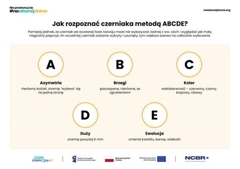 Infografika s pravidlom ABCDE pre samovyšetrenie znamienok