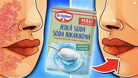 Účinky sódy bikarbóny na ľudské telo