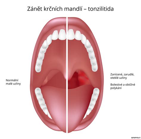 Ilustrácia anatomie krčných a nosových mandlí