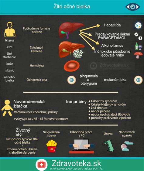 Infografika: Prehľad príčin a typov začervenania očí