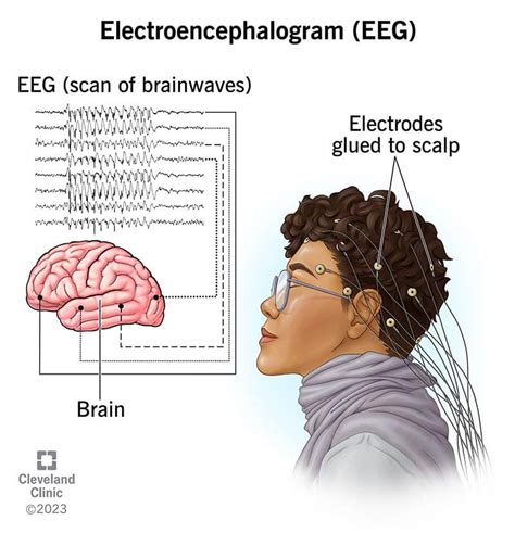 Schéma fungovania EEG