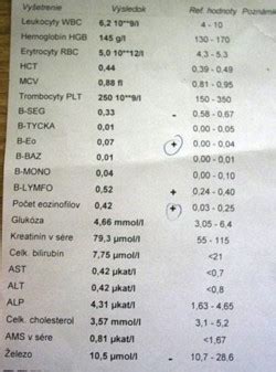 Výsledky testov dTest