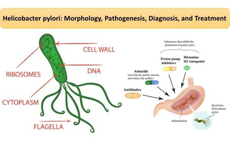 Prehľad diagnostických metód Helicobacter pylori