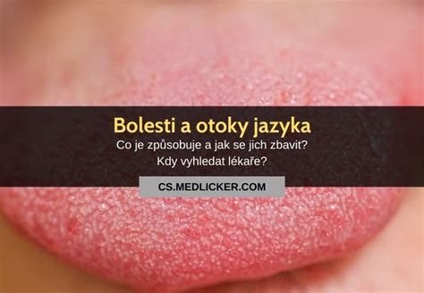 Anatómia jazyka s vyznačenými časťami a papilami