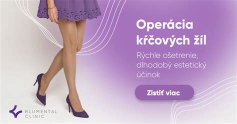 Tipy na zlepšenie krvného obehu a prevenciu kŕčových žíl