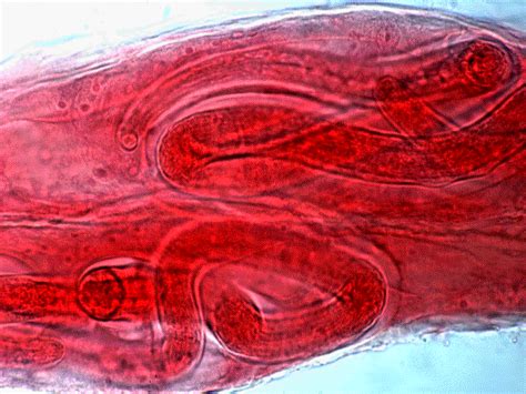 Detailná štruktúra svalovca Trichinella spiralis pod mikroskopom
