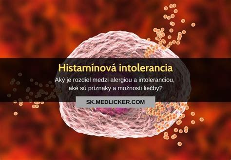 Histamínová intolerancia: príznaky a príčiny