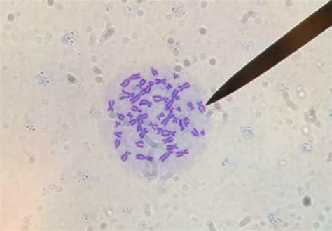 Baktéria Bacillus cereus pod mikroskopom