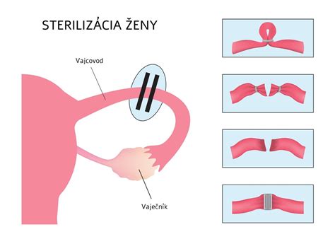 Sterilizácia zaváraných baraních rohov