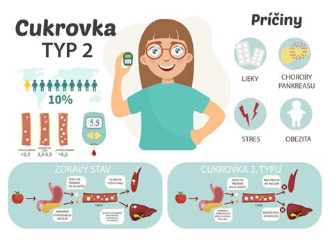 Schéma typov cukrovky a ich príčin