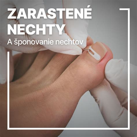 Možnosti ošetrenia zarastajúceho nechtu