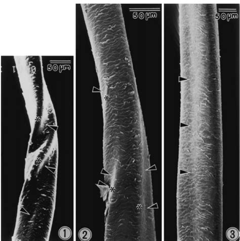 Štruktúra vlasového vlákna a pórovitosť
