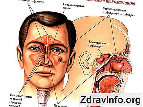 Mapa vedľajších nosových dutín na ľudskej lebke