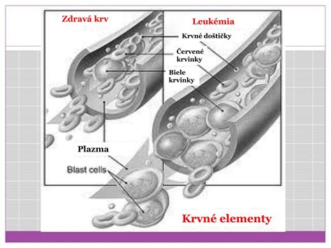 Schéma tvorby bielych krviniek v kostnej dreni