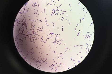 Mikroskopický pohľad na baktériu Bacillus cereus