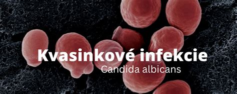 Ilustrácia kvasinky Candida albicans a jej vplyv na ústnu dutinu