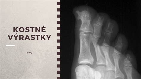 Schéma žíl na ľudskej nohe