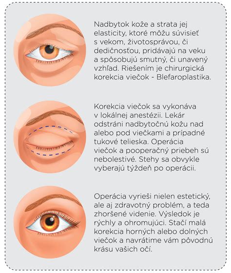 Detailná kontrola zatiahnutých viečok na zaváraných pohároch