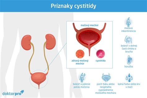 Rozdiely v anatómii močových ciest u žien a mužov