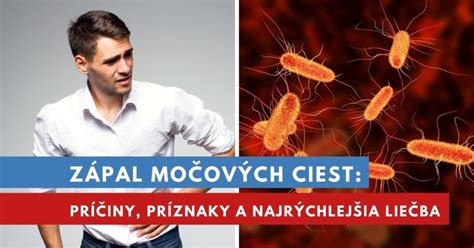 Baktéria E. coli ako častá príčina zápalov močových ciest