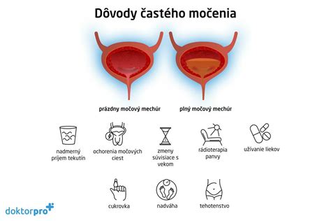 Infografika: Príčiny častého močenia